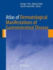 Atlas of Dermatological Manifestations of Gastrointestinal Disease1.jpg, 6.95 KB