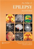 Atlas of Epilepsy (ENCYCLOPEDIA OF VISUAL MEDICINE SERIES) – 2nd Edition1.jpg, 6.18 KB