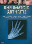 Rheumatoid Arthritis1.jpeg, 4.81 KB