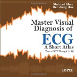 Master visual diagnosis ecg1.jpg, 7.45 KB