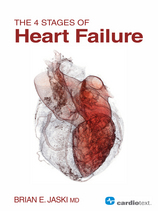 The 4 Stages of Heart Failure1.JPG, 26.3 KB