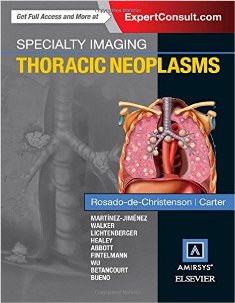 Speciality Thoracic Neoplasia1.jpg, 21.65 KB