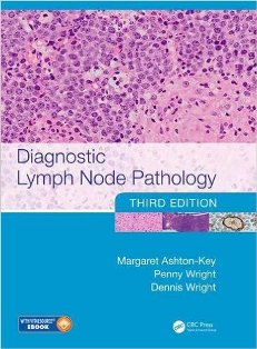 Diagnostic Lymph Node Pathology 1.jpg, 25.47 KB
