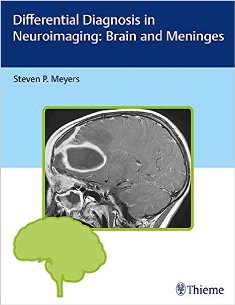 Differential Diagnosis in Neuroimaging Brain and Meninges 1.jpg, 17.79 KB