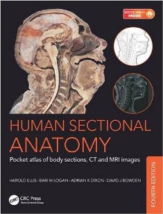 Human Sectional Anatomy 1.jpg, 22.48 KB