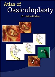 Atlas of Ossiculoplasty 1.jpg, 18.91 KB