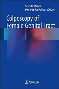 Colposcopy of Female Genital Tract 1.jpg, 11.74 KB