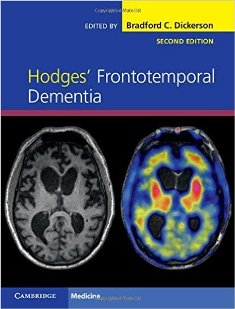 Hodges Frontotemporal Dementia 1.jpg, 21.29 KB