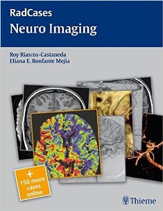 Radcases Neuro Imaging 1.jpg, 21.48 KB