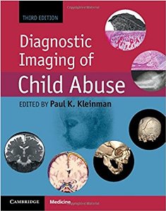 Diagnostic Imaging of Child Abuse 1.jpg, 22.96 KB