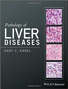 Pathology of Liver Diseases 1.jpg, 19.68 KB