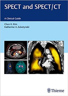 SPECT and SPECT CT 1.jpg, 18.27 KB