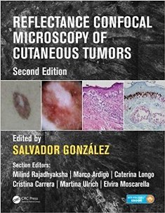 Reflectance Confocal Microscopy of Cutaneous Tumors 1.jpg, 30.01 KB