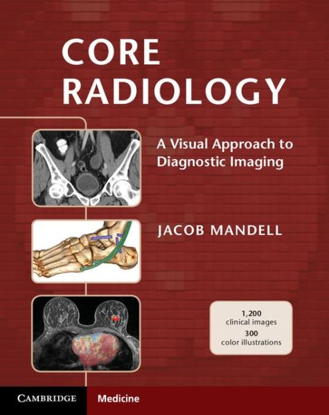 Core Radiology A Visual Approach to Diagnostic Imaging 1.jpg, 41.97 KB