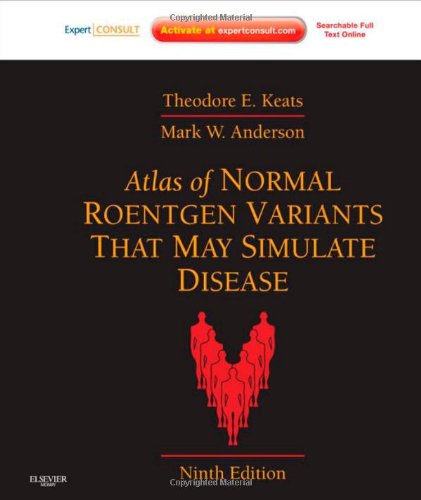 Atlas of Normal Roentgen Variants That May Simulate Disease 1.jpg, 27.43 KB