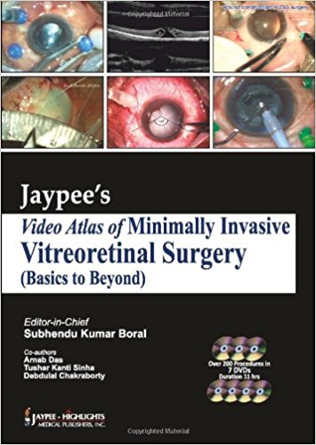 Jaypees Video Atlas of Minimally Invasive Vitreoretinal Surgery 1.jpg, 42.84 KB