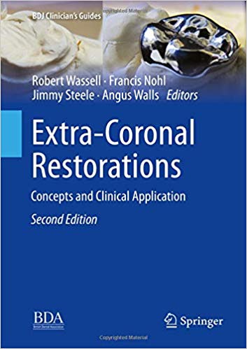 Extra-Coronal Restorations 1.jpg, 28.94 KB