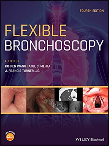 flexible bronchoscopy.jpg, 27.98 KB