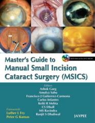 Master’s Guide to Manual Small Incision Cataract Surgery (MSICS)1.jpg, 10.99 KB