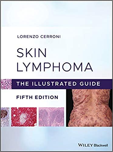 Skin Lymphoma.jpg, 23.4 KB