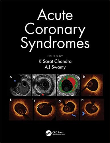 Acute Coronary Syndromes.jpg, 23.17 KB