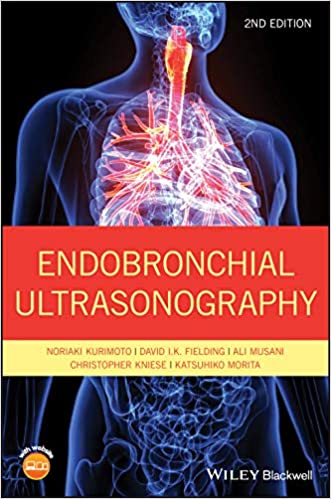 Endobronchial Ultrasonography.jpg, 35.77 KB