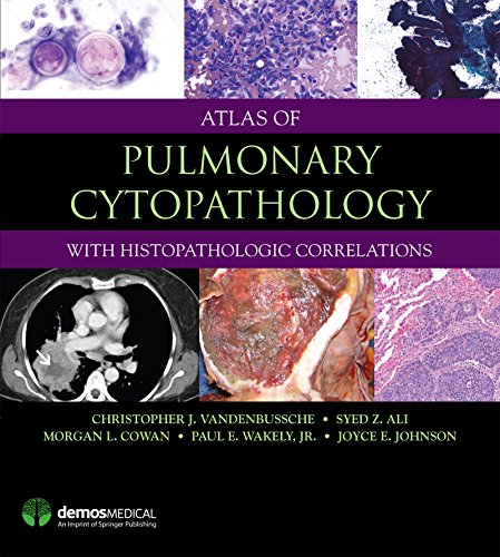 Atlas of Pulmonary Cytopathology.jpg, 67.63 KB