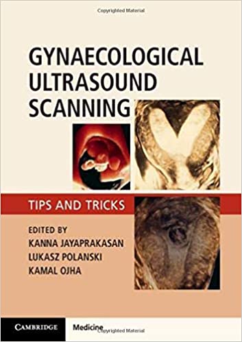 Gynaecological Ultrasound Scanning.jpg, 25.64 KB
