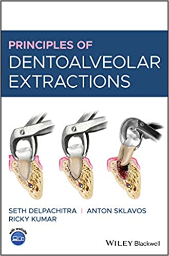 Principles of Dentoalveolar Extractions.jpg, 24.07 KB
