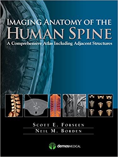 Imaging Anatomy of the Human Spine.jpg, 29 KB