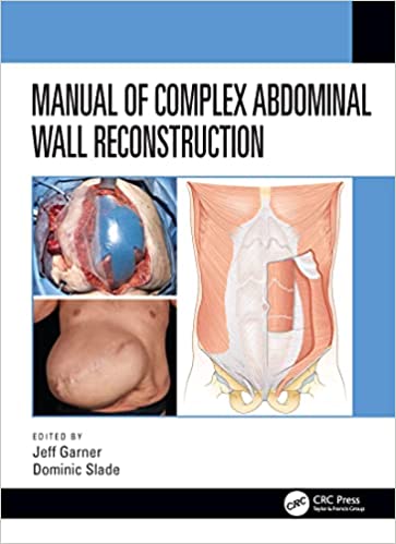 Manual of Complex Abdominal Wall Reconstruction.jpg, 25.88 KB