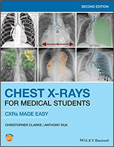 Chest X-Rays for Medical Students.jpg, 32.3 KB