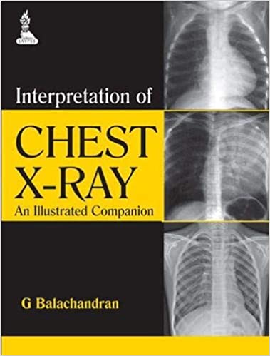 Interpretation of Chest X-Ray.jpg, 24.01 KB