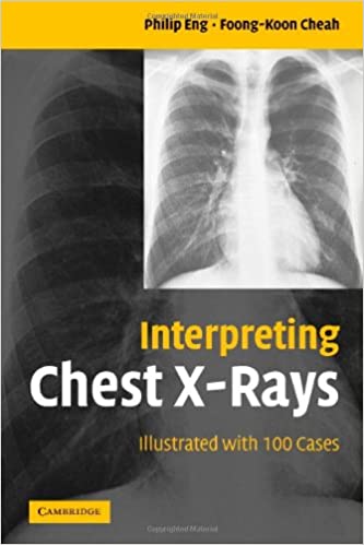 Interpreting Chest X-Rays.jpg, 19.84 KB