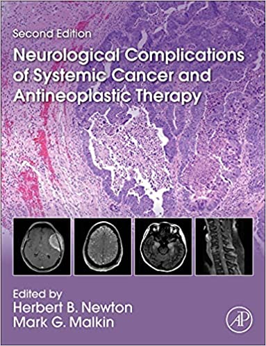 Neurological Complications of Systemic Cancer and Antineoplastic Therapy.jpg, 50.64 KB