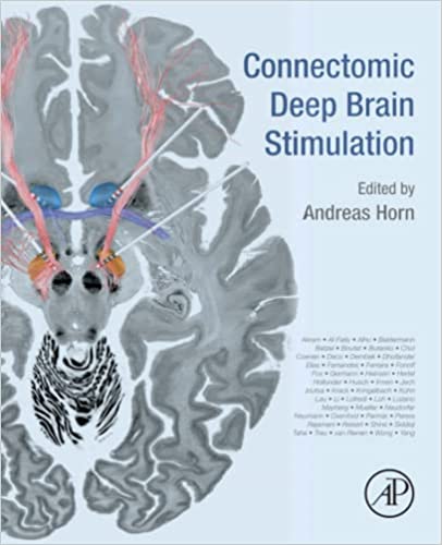 Connectomic Deep Brain Stimulation 1st Edition.jpg, 26.67 KB