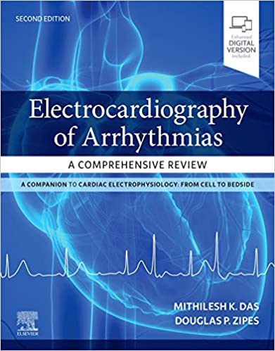 Electrocardiography of Arrhythmias.jpg, 36.11 KB