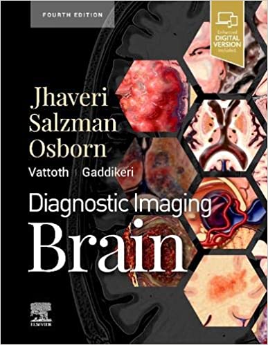 Diagnostic Imaging Brain 4th Edition.jpg, 38.58 KB