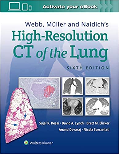 High-Resolution CT of the Lung Sixth Edition.jpg, 36.38 KB