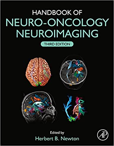 Handbook of Neuro-Oncology Neuroimaging.jpg, 25.9 KB