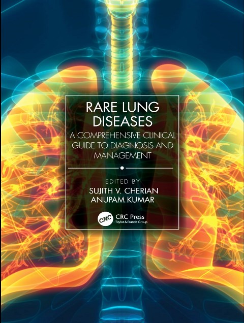 Rare Lung Disease-causing.jpg, 85.7 KB