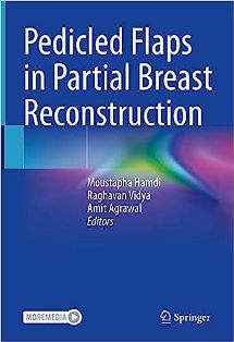 Pedicled Flaps in Partial Breast Reconstruction.jpg, 15.65 KB