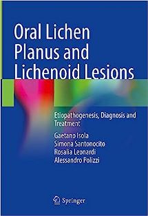Oral Lichen Planus and Lichenoid Lesions.jpg, 15.16 KB