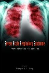 Severe Acute Respiratory Syndrome (Sars) From Benchtop to Bedside1.jpg, 7.34 KB