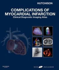 Complications of Myocardial Infarction1.jpg, 8.43 KB