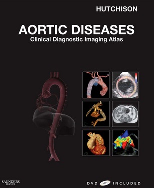 Aortic Diseases Clinical Diagnostic Imaging Atlas with DVD, 1e 2.jpg, 28.86 KB