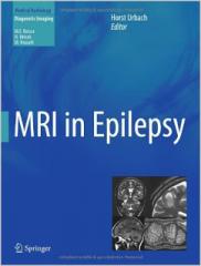 MRI In Epilepsy 20131.jpg, 7.64 KB