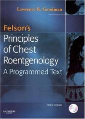 Felson Principles of Chest Roentgenology 3rd Edition1.jpg, 8.66 KB