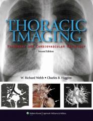 Thoracic Imaging Pulmonary and Cardiovascular Radiology, 2nd Edition1.jpg, 10.8 KB