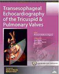 Transesophageal Echocardiography of the Tricuspid and Pulmonary Valves1.jpg, 9.8 KB